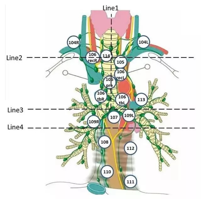 八个细节助你远离食管癌,哪些人要警惕食管癌