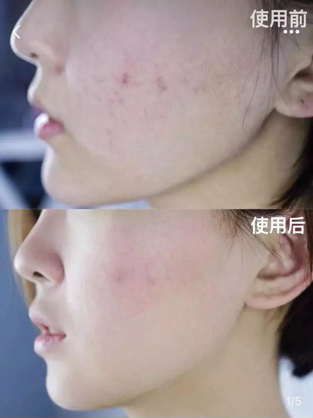 补水涂抹式面膜复活草,ph复活草涂抹面膜