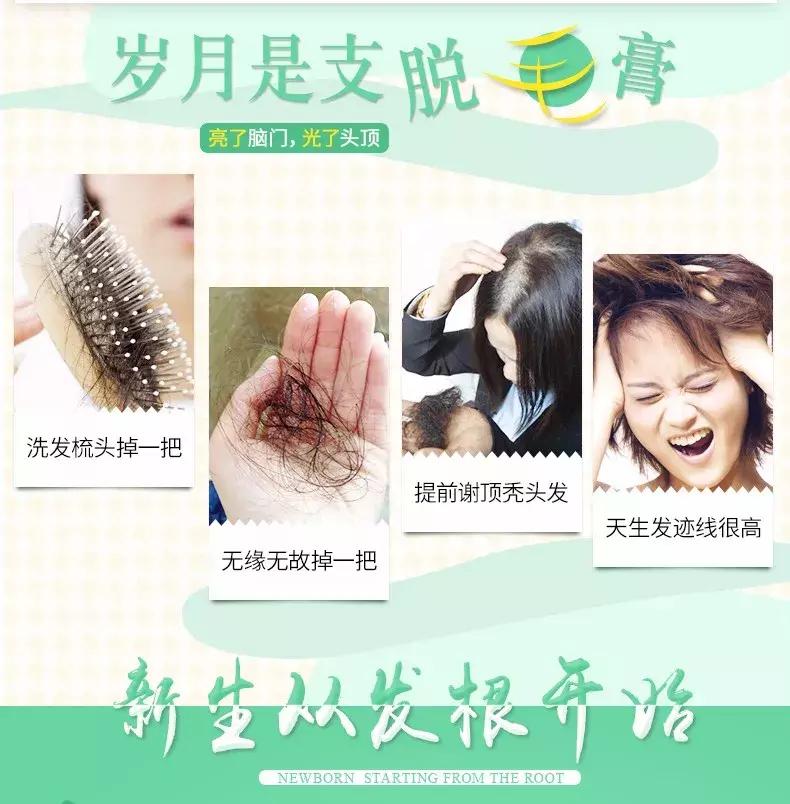 发际线高脱发用什么洗发水,发际线高掉头发洗发水测评
