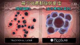 整容四大危险手术,整容的七大骗局