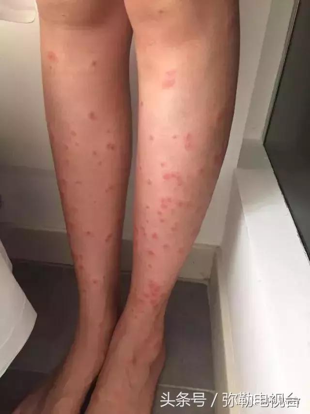 弥勒蚊虫消杀,弥勒病媒消杀