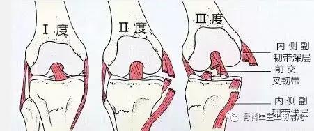 最新的人工膝关节使用寿命,膝关节使用说明