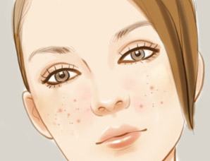 脸上的白头粉刺怎么去除简单方法,白头粉刺刺破变成红点