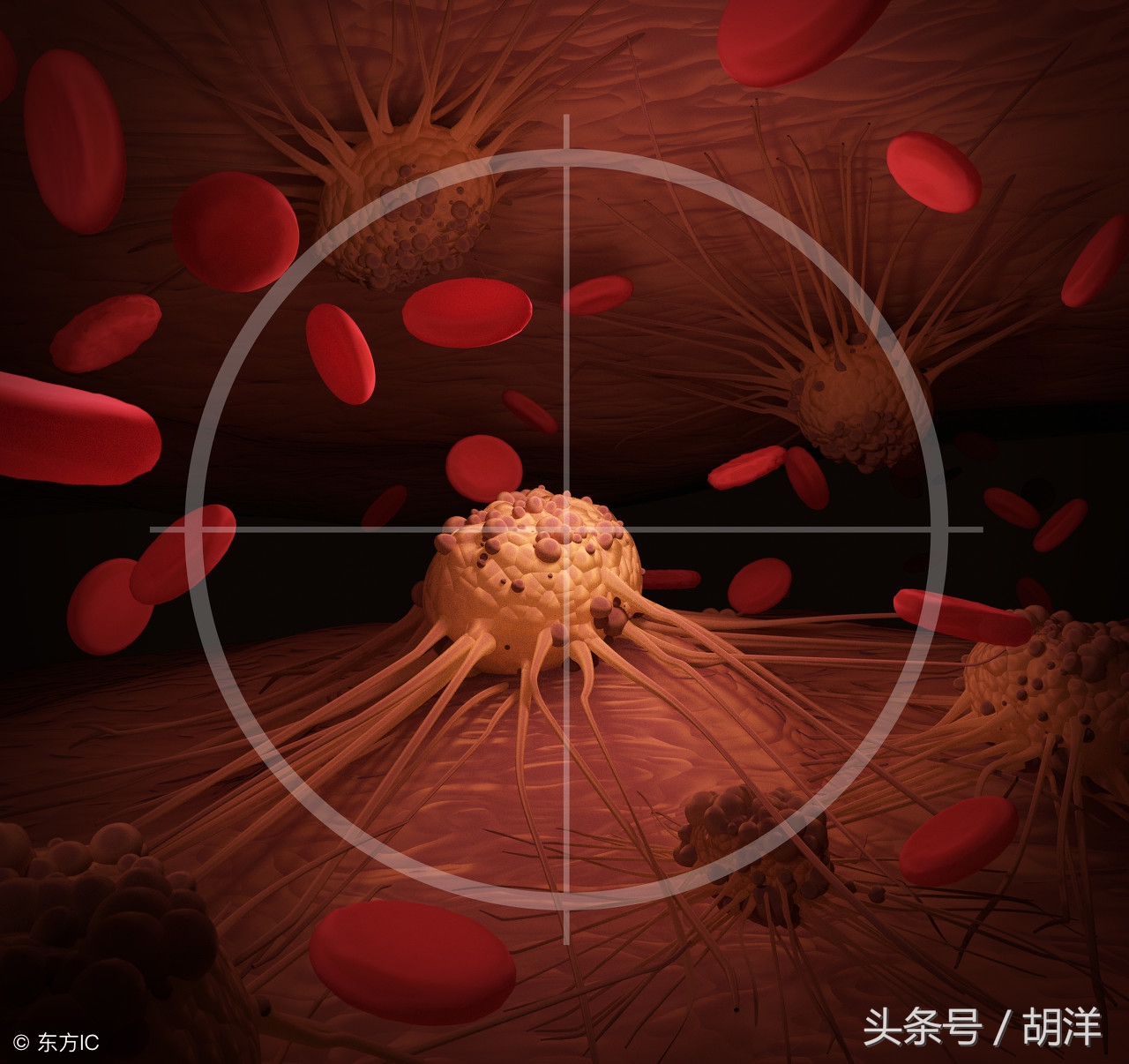 肺癌转移还能活多久,我的一些病人已活过9年,他们是怎么做到的