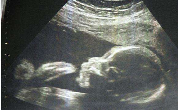 人工流产后生气会造成什么危害,人工流产的十大风险