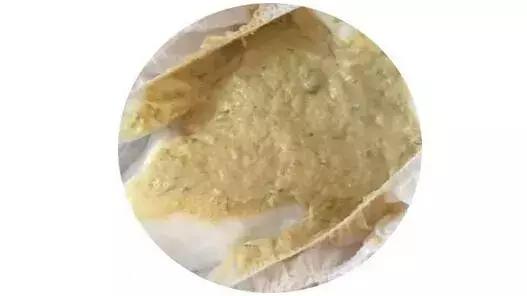 宝宝拉灰白屎,婴儿拉黄白色稀屎怎么办