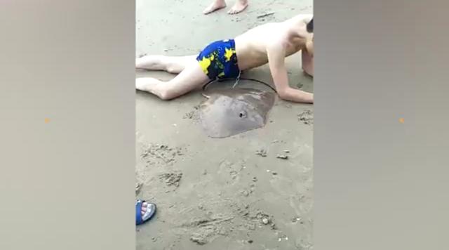 想想就很疼！魔鬼鱼刺入三亚男性游客*体下**，这是什么操作