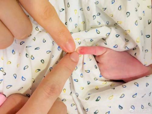 婴儿螳螂嘴图片及征兆,婴幼儿螳螂嘴生理现象