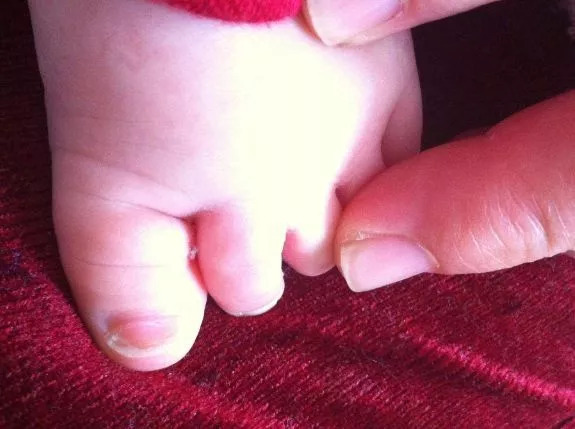 5个选鞋秘籍！护好娃的脚和腿！