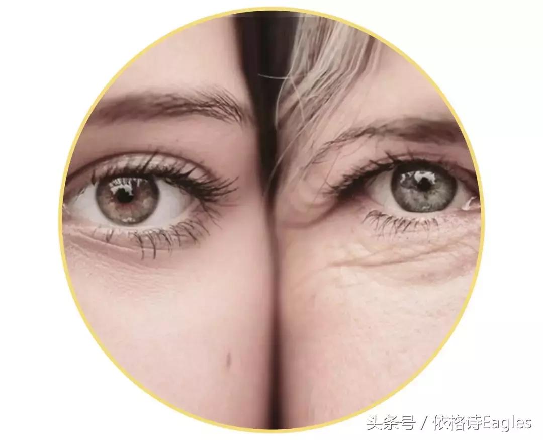 怎么去除黑眼圈和细纹,黑眼圈细纹还有得救吗