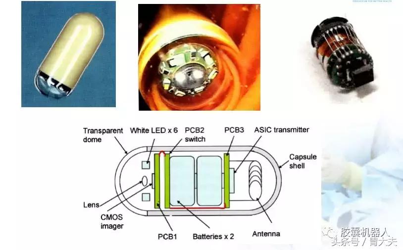 全球最先进磁控胶囊胃镜出自武汉,中国磁控胶囊胃镜临床应用指南