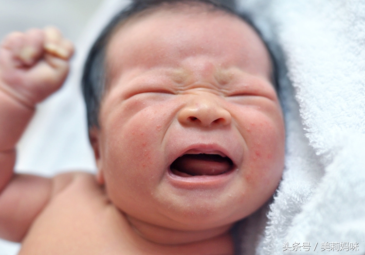 婴儿粟粒疹症状,婴儿粟粒疹越来越多怎么办