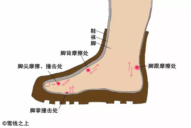 陶冶重庆｜徒步时，如何防治水泡？