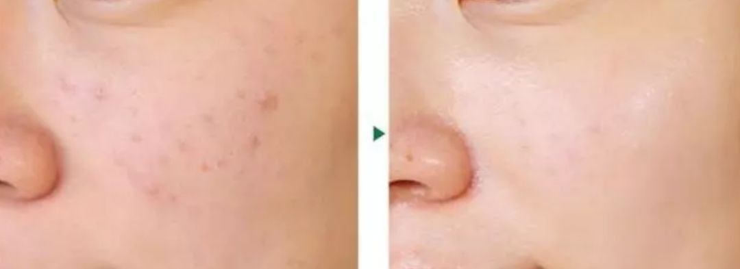 美白爱马仕,美白水200ml