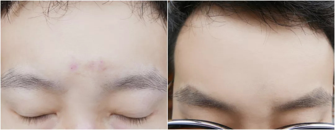 法国“奇愈”｜只需一晚就能治愈痘印的地方，你想去吗？