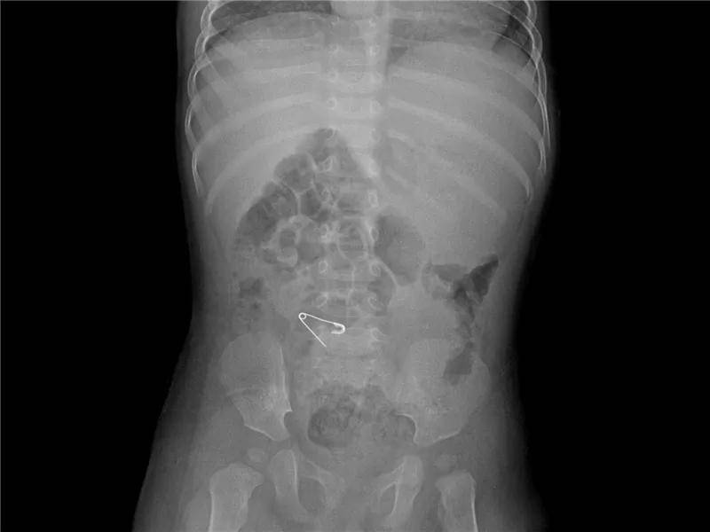 一些让人毛骨悚然拍到的照片,六个令人毛骨悚然的影像