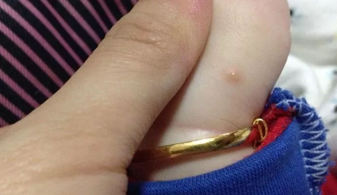 靖江疫情最新公布数据,江苏靖江疫情有几例患者