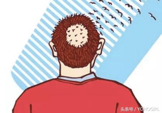 头皮和身上长痘,头皮油脸长痘