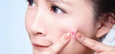 七年级成长的烦恼青春痘,青春痘带来的烦恼