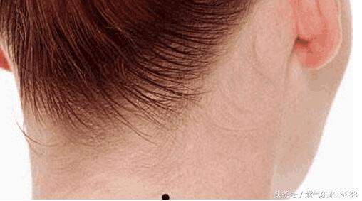痣相图解:女人脖子上有痣图解