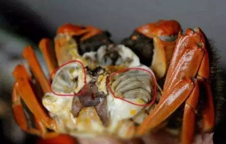 小孩感染肺吸虫,2岁女童吃河蟹肺吸虫