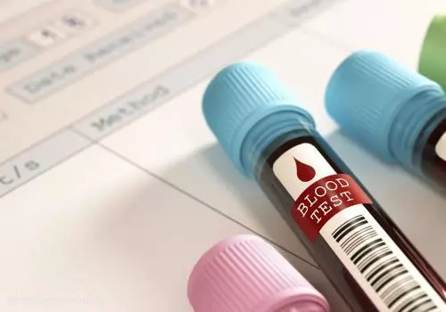 老年人钾高有什么危害,高钾血症的表现和危害