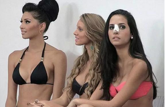 在选美之国，你不美，可能真的会死