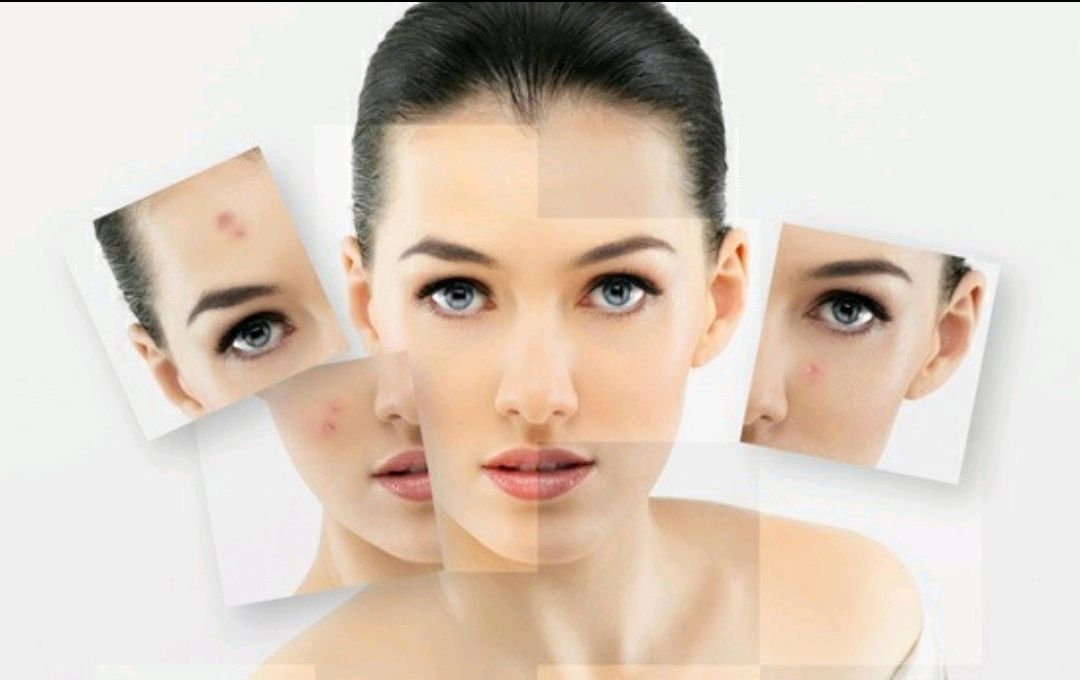 果酸焕肤有用吗,果酸换肤祛斑吗