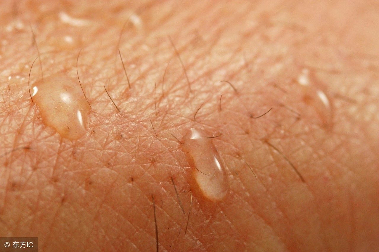后背螨虫怎么去除最快方法,后背的螨虫和痘痘怎么去掉
