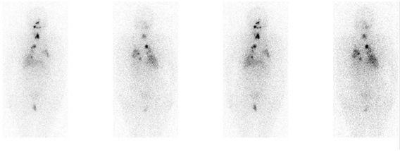三个方法战胜癌症赶紧学起来,最不容易治愈的十种癌症