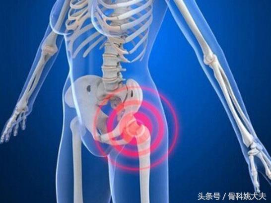 红斑狼疮吃1粒激素严重吗,得了红斑狼疮没有钱治疗怎么办啊