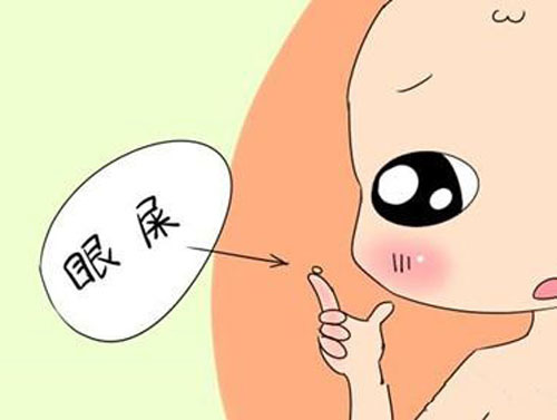 宝宝眼屎多怎么办试试这些小妙招,宝宝眼屎多怎样治最快最有效