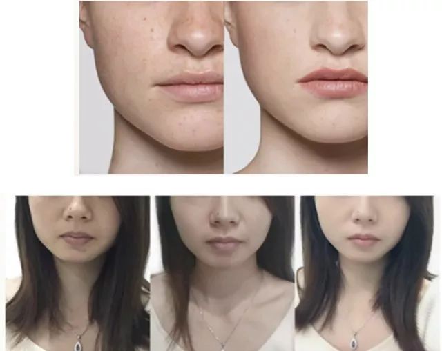 澳洲美白丸推荐,澳洲美白丸真的有效吗