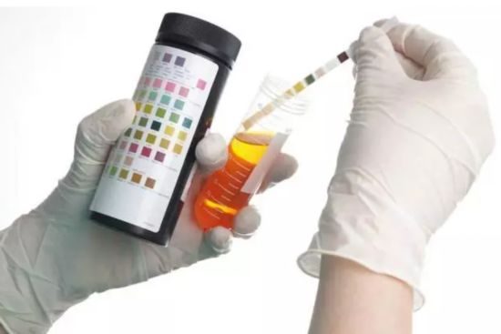 尿路末端结石会尿频尿急尿痛,尿路狭窄会引起尿频尿急尿痛吗