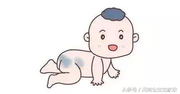 宝宝这样是正常现象吗？新手妈妈最爱问的11个问题这样答！