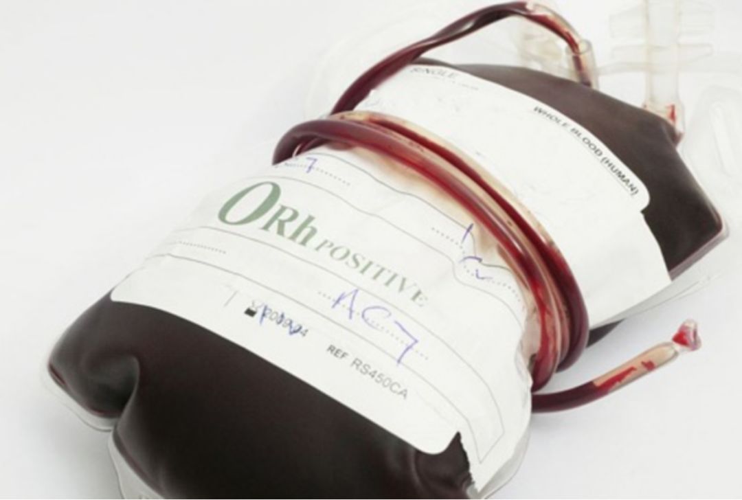 abo熊猫血中最稀有的血型,除熊猫血外什么常见血型最稀有