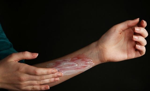 人体器官手术后愈合期要多久,手术内部伤口多久痊愈