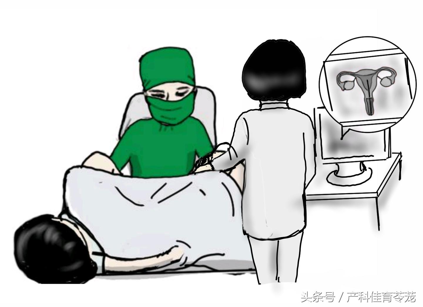 这三个地方出血可能是癌,绒癌出血能止住吗