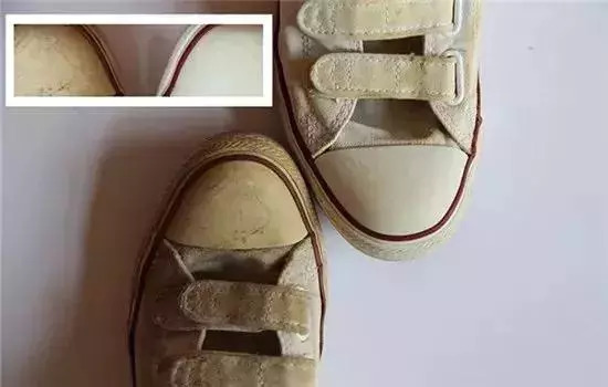 鞋子发黄发霉怎么变白生活小妙招,鞋子发霉了怎么洗掉黑点