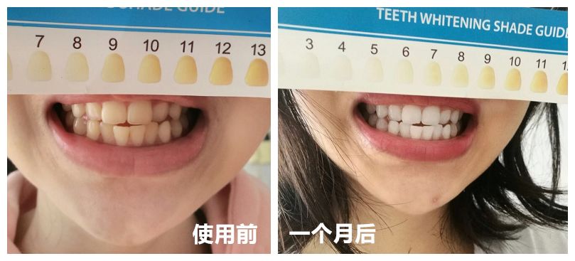 牙膏为什么能把鹌鹑蛋刷白,刷白鹌鹑蛋的牙膏