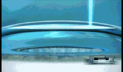 治疗近视不复发,近视治疗真的靠谱吗