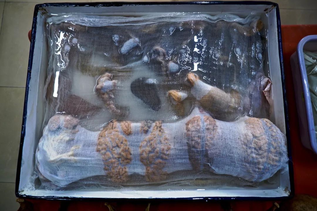 中国脑囊虫病,巨大脑囊虫病