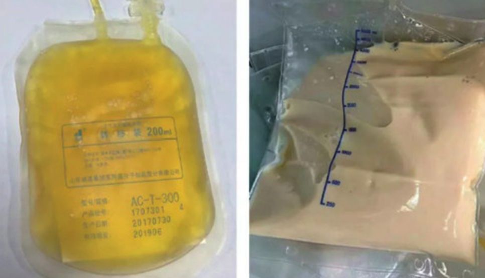 好好吃饭才是最好的爱自己,好好吃饭就是对生命的最好尊重