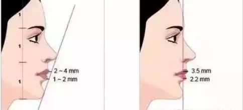 下巴填充和假体植入哪个好,下巴填充膨体跟硅胶哪个更好