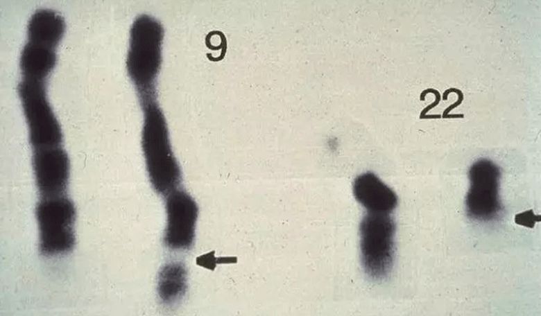诺贝尔医学奖得主揭露惊人真相,治愈癌症获得诺贝尔奖