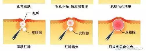 竟然连大幂幂都有解决不了的肌肤问题？