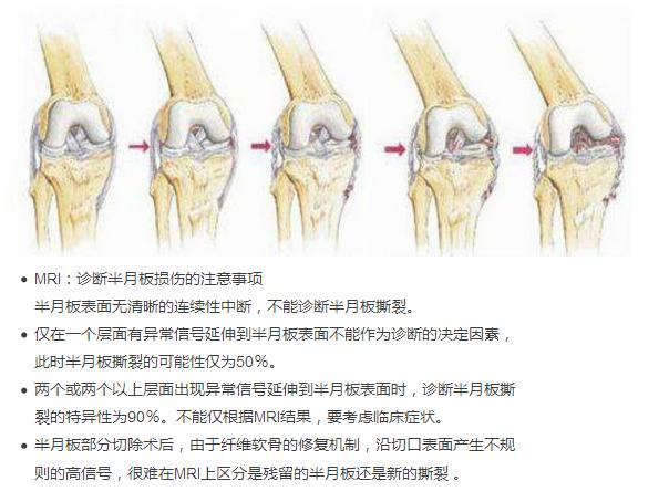 常见的十大膝关节疼痛,老年患者膝关节疾病健康科普