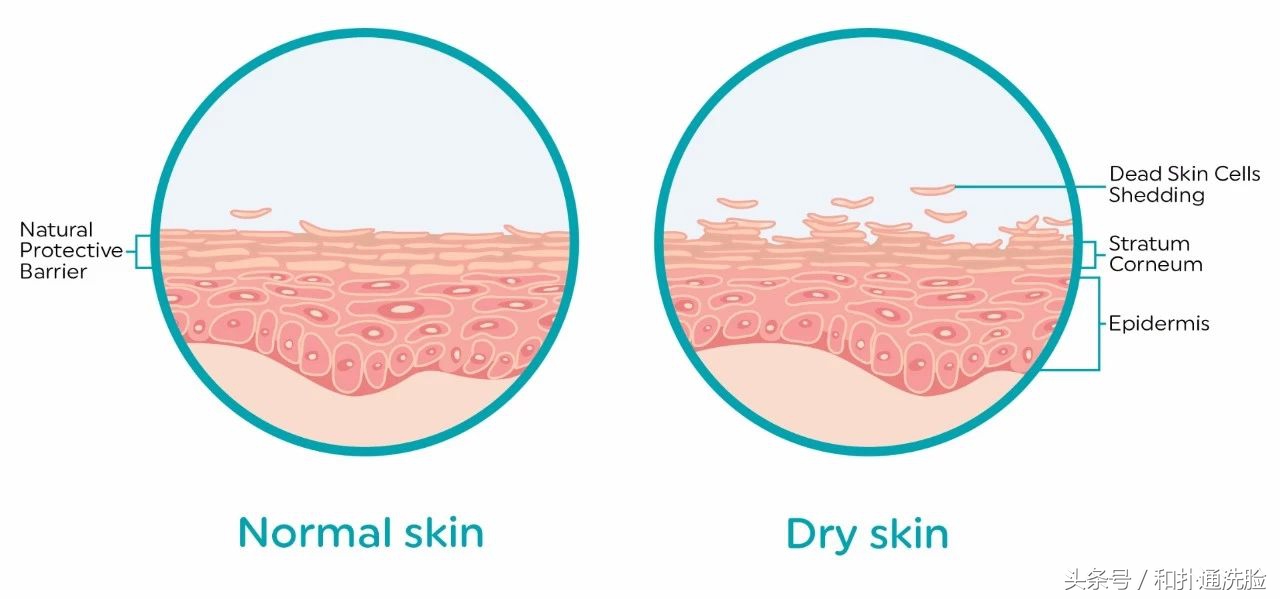 看干皮在秋冬笑着活下去!