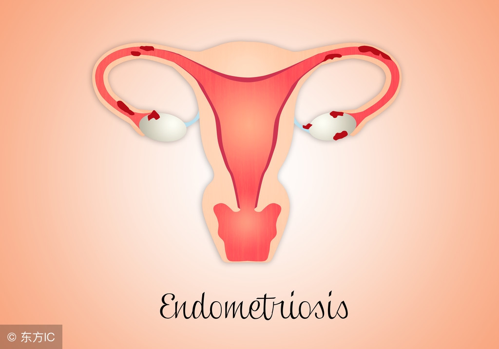 子宫后位怀孕是垫枕头还是俯卧,子宫后位孕早期腰酸是怎么回事