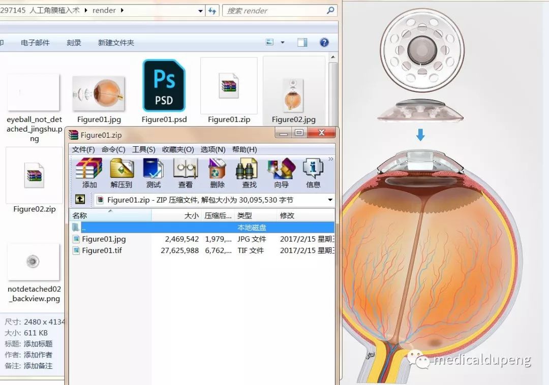 医学插画插图,医学插画sci